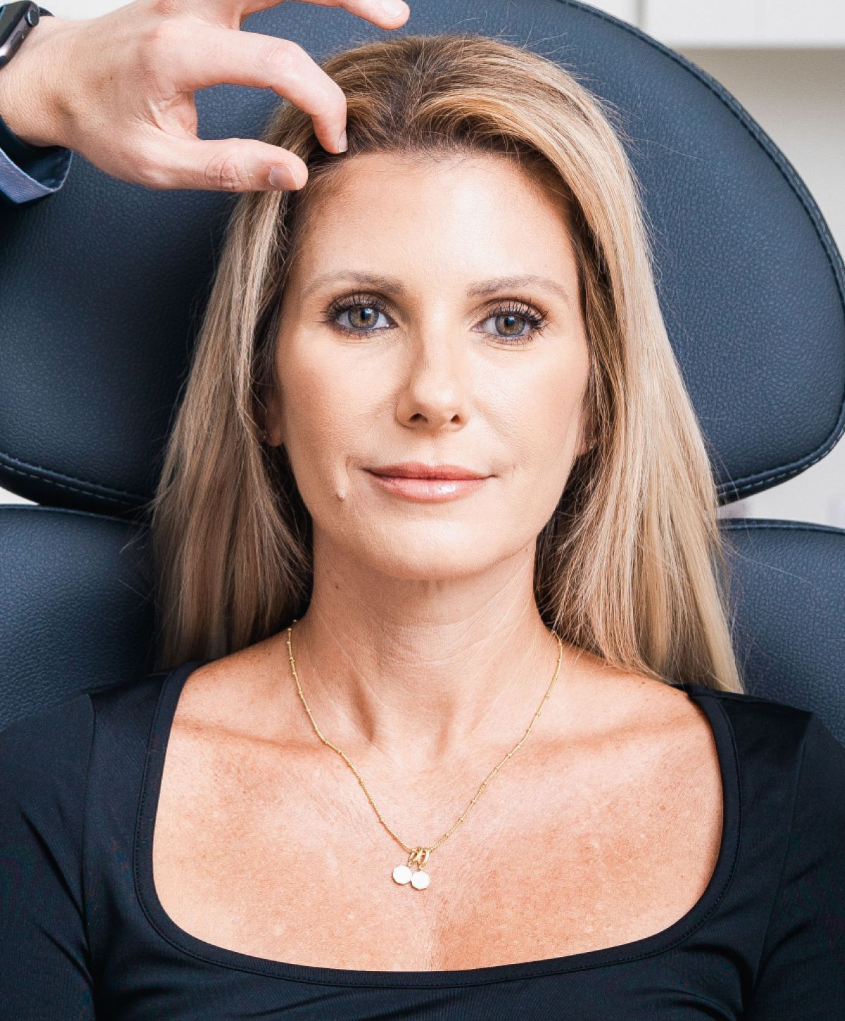 Newport Beach brow lift model