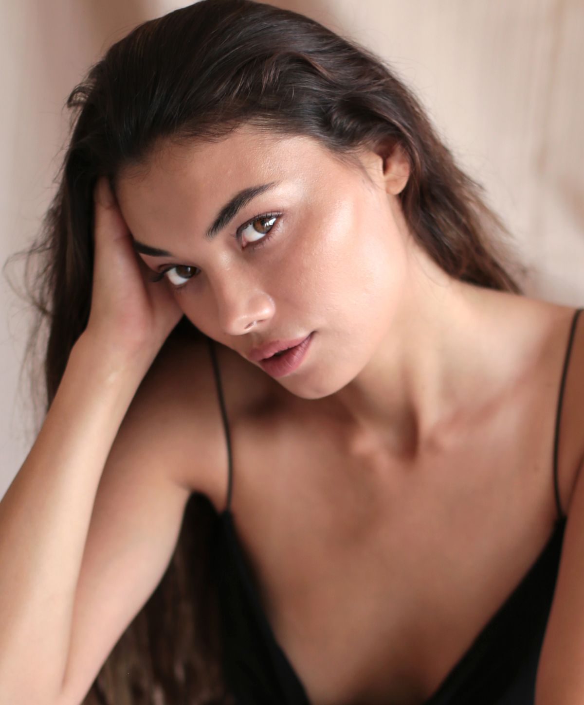 Newport Beach buccal fat removal model